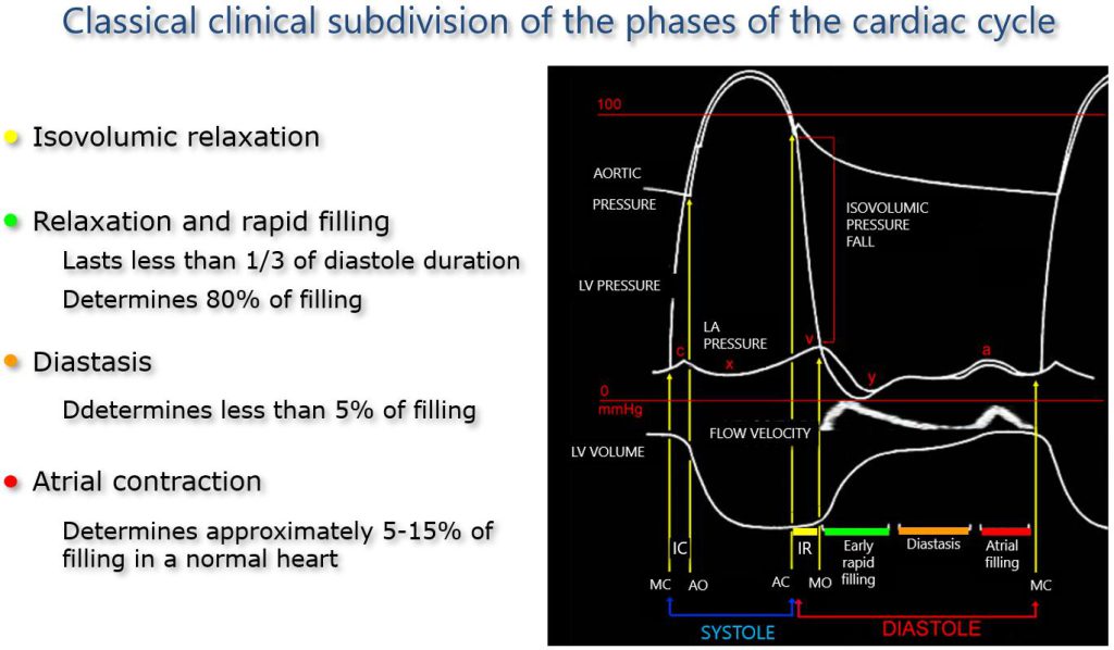 Figure 6a. Phases of diastolic function.