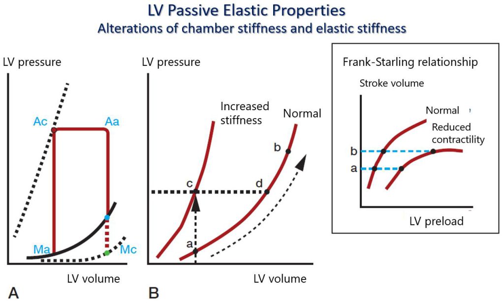 Figure 7. LV passive elastic properties. Alterations of chamber stiffness and elastic stiffness