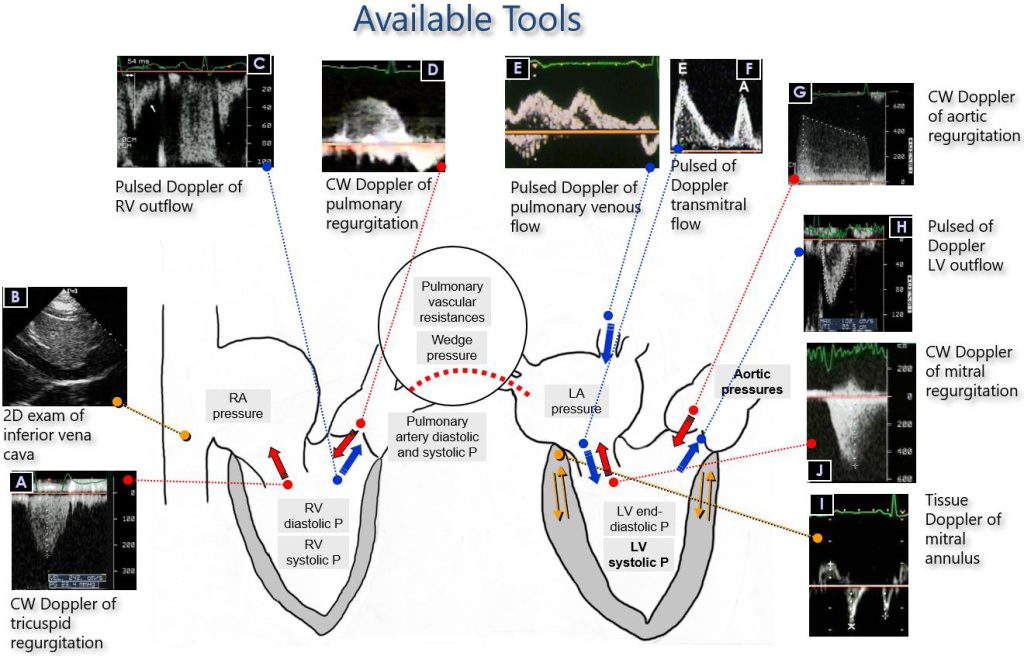 Figure 8. The Doppler ultrasound "tool map" useful for performing a complete non-invasive hemodynamic examination for the analysis of left ventricular diastolic function.