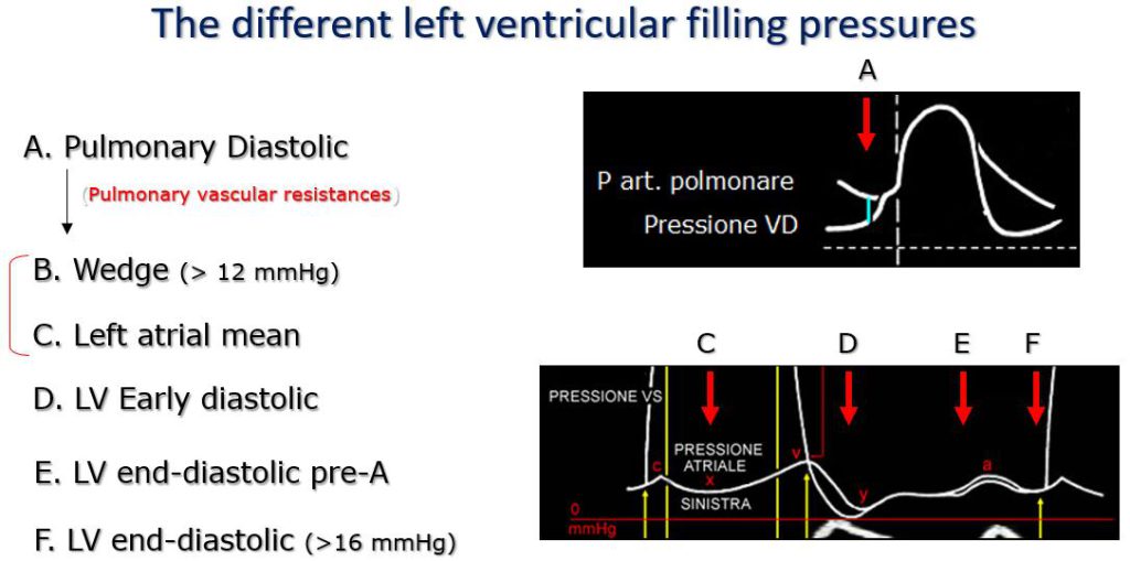 Figure 14. The different left ventricular filling pressures