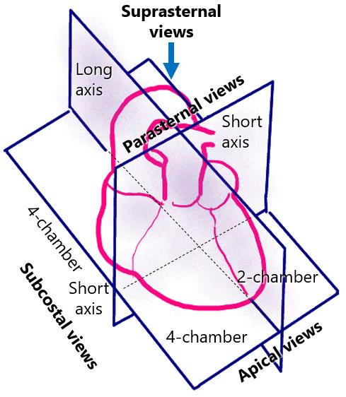 Figure 1. Available echocardiographic transthoracic views. 