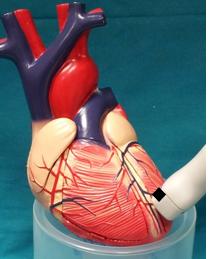 Figure 33. Transducer position, parasternal short axis left ventricular apex