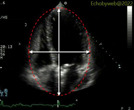 Ellipsoid geometry of the apical 4-chambers view with correct imaging of the true left ventricular long axis