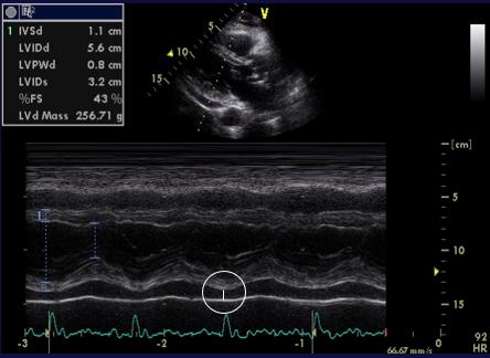 Figure 28. M-mode parasternal long axis, left ventricle, mild to moderate effusion