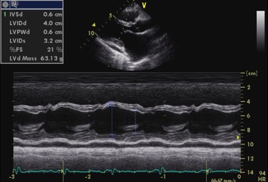 M-mode echocardiogram of the left ventricle with mild posterior effusion