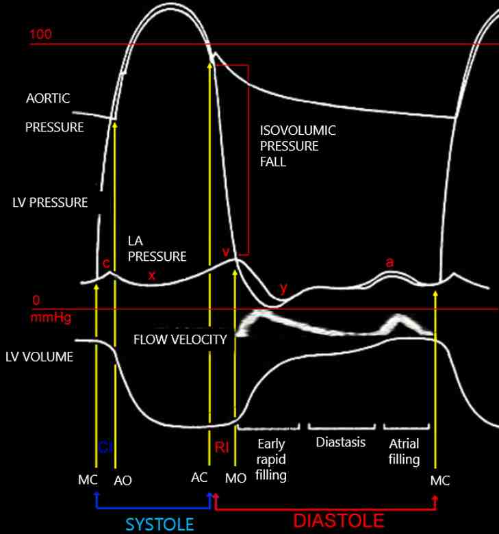 Figura 13A - Il ciclo cardiaco: dall'alto in basso: pressione aortica, pressione VS, pressione atriale sinistra, flusso transmitralico (Doppler pulsato), volume VS