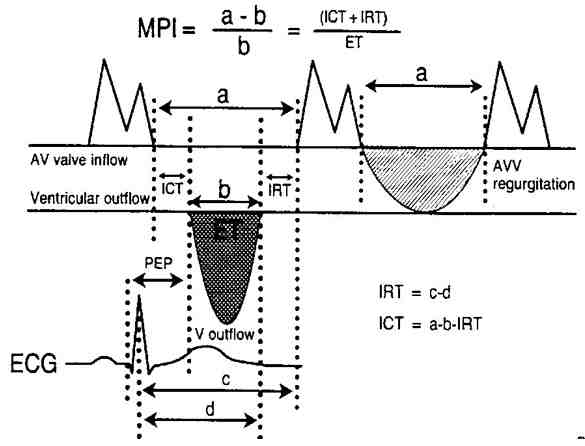 Figura 11a - Le misure per calcolare il Myocardial Performance Index (MPI) con il Doppler pulsato di influsso (mitrale)  ed efflusso VS