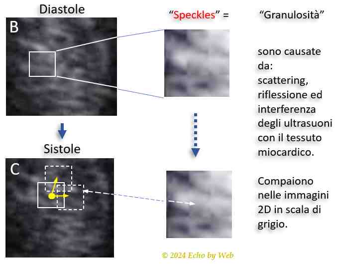 Figura 37bc -  Gli speckles miocardici