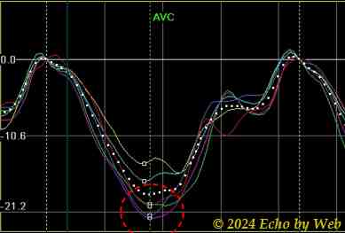 Figura 48c -  Curve segmentarie di strain miocardico 